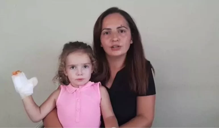 İçinde Patlayıcı Gaz Bulunan Balon, Minik Çocuğun Bedenini Yanık İçinde Bıraktı
